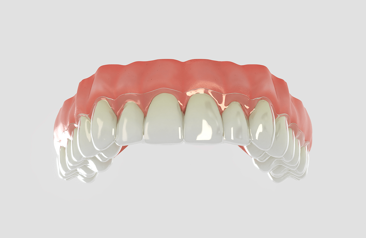 Clearfy Florida Blog Aligners